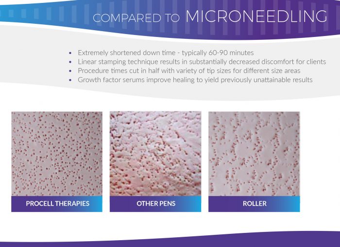 ComparisonProcell